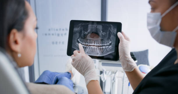 Licensed Dental Veneers service in Hunters Creek Village, TX - Smile Center Dentistry